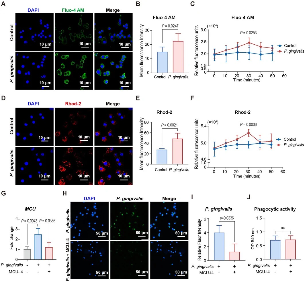 P. gingivalis infection impairs the intracellular bacteria clearance in macrophages through MCU-mediated Ca2+ overload. (A) Representative fluorescence images showing the levels of the cytosolic Ca2+ (Fluo-4 AM, green) in control and P. gingivalis-infected macrophages. (B) Quantification of Fluo-4 AM MFI. (C) The changes of Fluo-4 AM levels in control and P. gingivalis-infected macrophages over a 50-min period. (D) Representative fluorescence images showing the levels of the mitochondrial Ca2+ (Rhod-2, red) in control and P. gingivalis-infected macrophages. (E) Quantification of Rhod-2 MFI. (F) The changes of Rhod-2 AM levels in control and P. gingivalis-infected macrophages over a 50-min period. (G) The MCU gene expression in macrophages between control, P. gingivalis, and P. gingivalis + MCU-i4 (MCU inhibitor, 10 uM) group. (H) Representative IF images showing the intracellular survival of P. gingivalis in macrophages between P. gingivalis and P. gingivalis + MCU-i4 groups. (I) Quantification of P. gingivalis MFI. (J) Quantification of phagocytic activity (OD 540 nm) in macrophages between P. gingivalis and P. gingivalis + MCU-i4 groups.