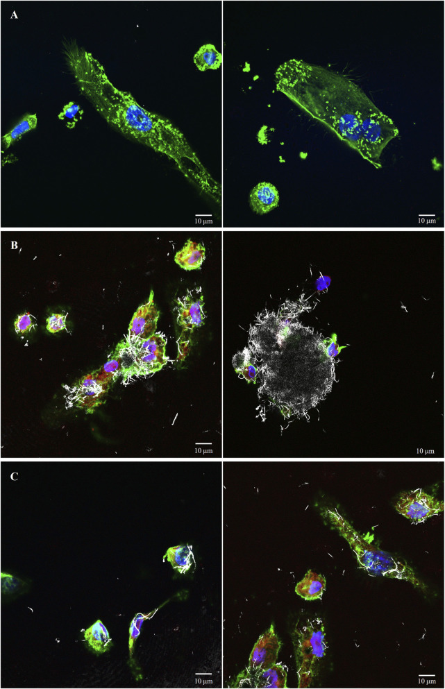 Representative confocal images of PMA-differentiated THP-1 cells in serum-supplemented medium. (A) Control, unexposed PMA-differentiated cells. (B,C) PMA-differentiated cells (condition 1 and condition 2 respectively) exposed to NM-401 for 24 h. NM-401 particles are shown in white (reflectance). Blue indicates the nuclei (stained with Hoechst 33342), and in green the cell membrane (stained with Rhodamine Phalloidin), in red the lysosomes (stained with Lysotracker). Images are acquired on Zeiss LSM 880 (x63 objective). Scale bar: 10 um.