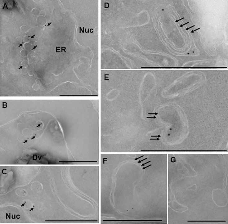 Detection of structures surrounded by four membranes in the "apicoplast-minus" parasites by immuno-EM. (A-C) ACP-positive structures surrounded by a single membrane (short black arrows). (D-F) ACP-positive structures surrounded by four membranes (long black arrows). (G) negative control with no primary antibody. Bars = 500 nm. Data are representative from two independent experiments.