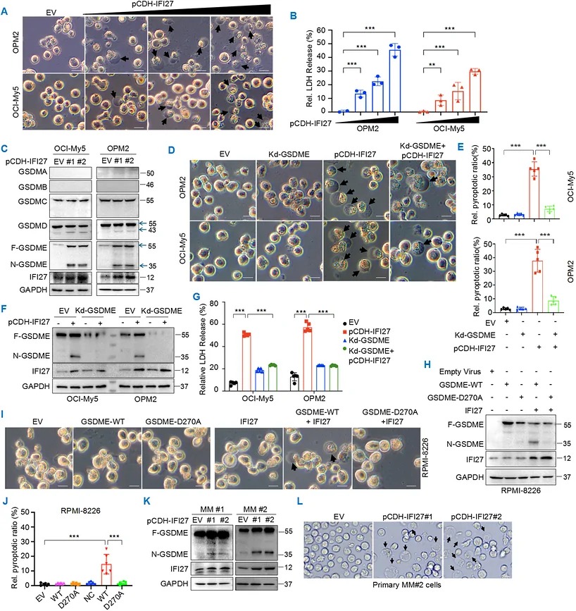 IFI27 induces myeloma cell pyroptosis in a GSDME-dependent manner. (A, B) OCI-My5 and OPM2 cells were infected with increased IFI27 lentivirus as indicated, followed by pyroptosis morphology determination (A), and culture media were subjected to LDH measurement (B) (n = 3), after 72 h of overexpression of IFI27 with a concentration gradient. Scale bar, 20 um. (C) Myeloma cell lines were infected with IFI27 lentivirus for 72 h before cell lysates were prepared for IB assays against different GSDMs. (D-G) GSDME was stably knocked down from OCI-My5 and OPM2 cells by its specific sgRNA, followed by infection with IFI27 lentivirus. Seventy-two h later, cells were performed to phase-contrast microscopy analysis (D) and statistical analysis on pyroptotic cells (E); cell lysates were prepared for IB assays (F) and culture media were subjected to LDH release measurement (G) (n = 5). Scale bar, 20 um. (H-J) RPMI-8226 cells were infected with WT or D270A GSDME lentivirus alone or with IFI27 lentivirus for 72 h for IB assays (H), pyroptotic analysis on phase-contrast microscopy (I), and statistical analysis of pyroptosis rate of cells (J) (n = 6). Scale bar, 20 um. (K, L) Primary myeloma cells were infected with IFI27 lentivirus for 72 h followed by IB assays using cell lysates (K) and phase-contrast microscopy assays (L). Scale bar, 10 um. **, p < 0.01; ***, p < 0.001. EV, empty virus.